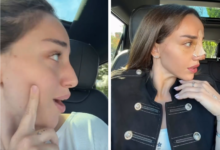 Photo of „გავიტეხე ცხვირი და მქონდა კეხი“