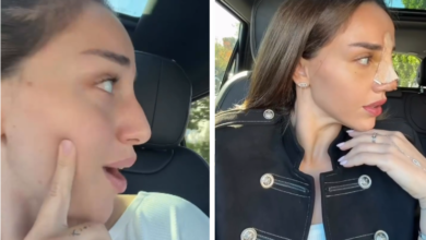 Photo of „გავიტეხე ცხვირი და მქონდა კეხი“