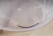 Photo of „სავარაუდოდ, ექიმს ნემსი ჩაუტყდა“