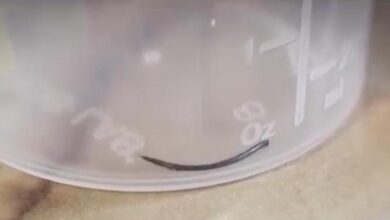 Photo of „სავარაუდოდ, ექიმს ნემსი ჩაუტყდა“